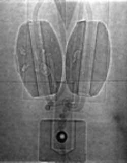 phase contrast imaging